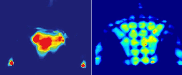 ピロー有り無し　ビフォーアフター