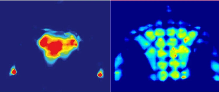 ピロー有り無し　ビフォーアフター